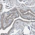 Anti-CERKL Antibody