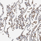 Anti-CERKL Antibody