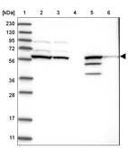 Anti-CERKL Antibody