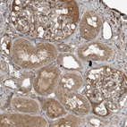 Anti-PRRT3 Antibody