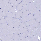 Anti-LIPF Antibody