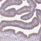 Anti-TSPAN31 Antibody