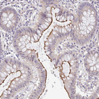 Anti-TSPAN31 Antibody