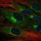 Anti-CLEC14A Antibody