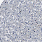 Anti-RBM28 Antibody