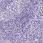 Anti-DDX4 Antibody