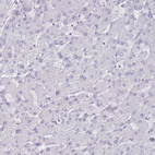 Anti-DDX4 Antibody