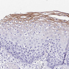 Anti-TMPRSS11E Antibody