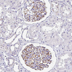 Anti-TMPRSS11E Antibody