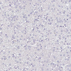 Anti-TMPRSS11E Antibody