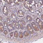 Anti-CEP295 Antibody