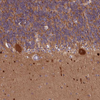 Anti-CEP295 Antibody