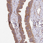 Anti-CEP295 Antibody