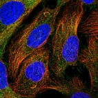 Anti-CEP295 Antibody