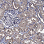 Anti-CTU2 Antibody