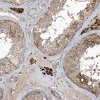 Anti-ZNF263 Antibody