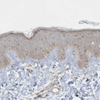 Anti-ZNF263 Antibody