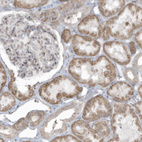 Anti-ZNF263 Antibody