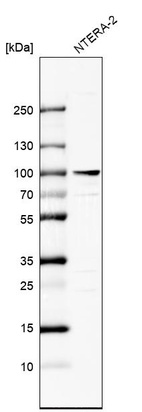 Anti-ZNF263 Antibody