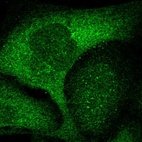 Anti-ZNF263 Antibody