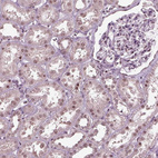 Anti-RUVBL2 Antibody