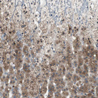 Anti-PTPRN2 Antibody