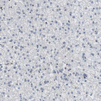 Anti-LXN Antibody