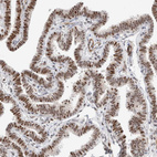 Anti-ID3 Antibody