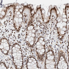 Anti-ID3 Antibody