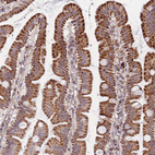 Immunohistochemical staining of human small intestine shows strong granular cytoplasmic positivity in glandular cells.