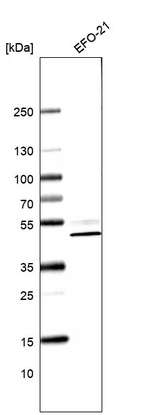 Western blot analysis in human cell line EFO-21.