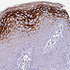 Immunohistochemical staining of human skin shows strong membranous positivity in squamous epithelial cells.